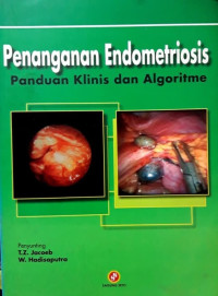 Image of Penanganan Endometriosis