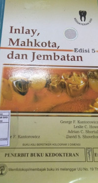 Image of Inlay mahkota dan jembatan