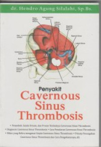 Image of Penyakit Cavernous Sinus Thrombosis