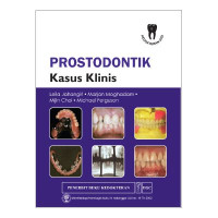 Image of Prostodontik Kasus Klinis